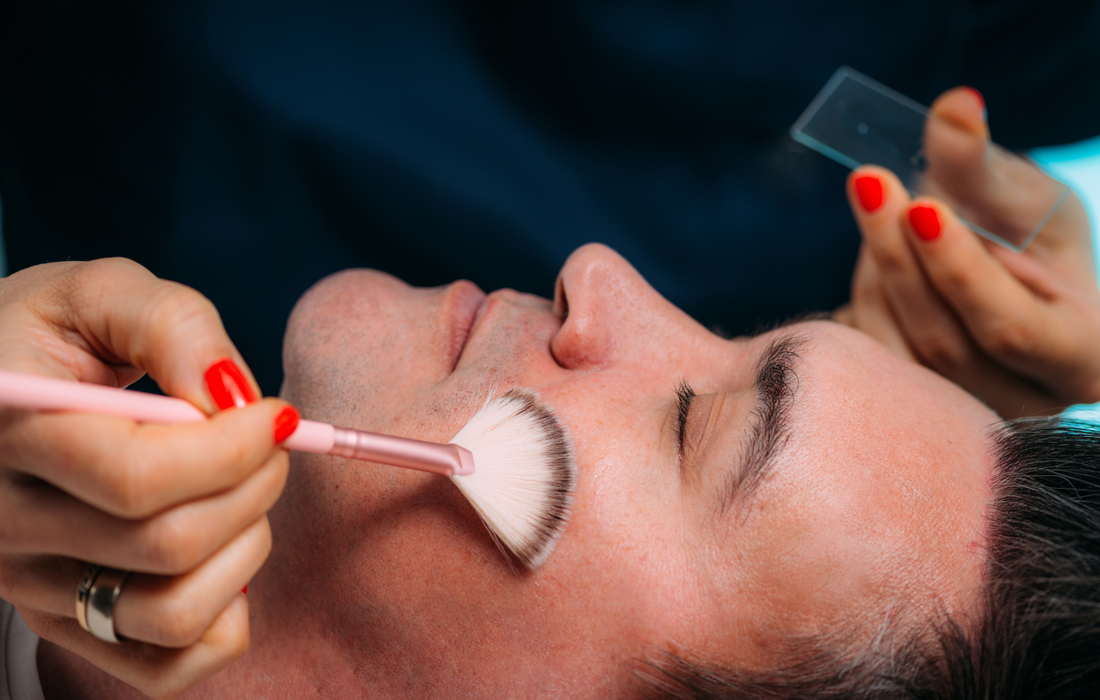 Understanding Different Types of Chemical Peels