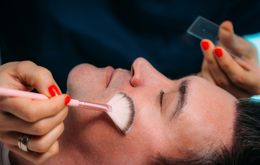 Understanding Different Types of Chemical Peels