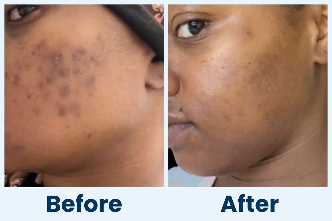 Clean Skin Club