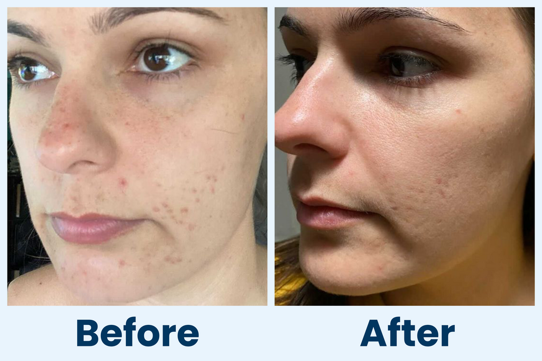 Clean Skin Club