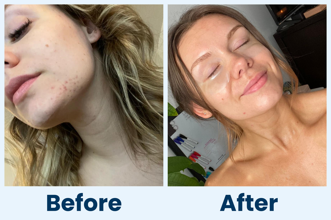 Clean Skin Club