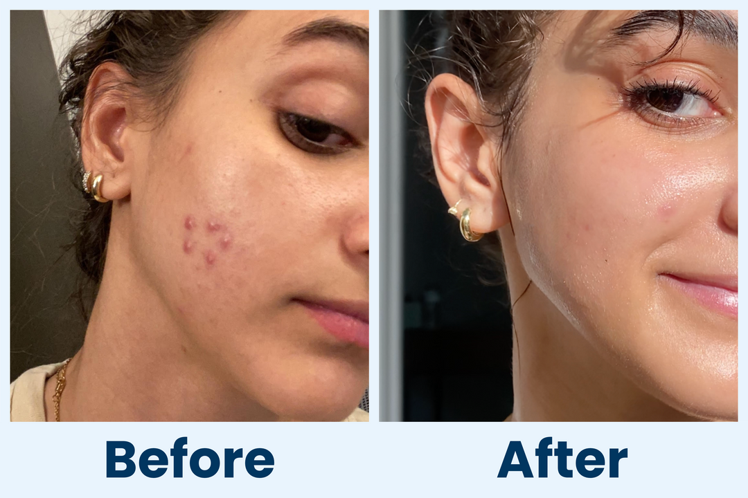 Clean Skin Club