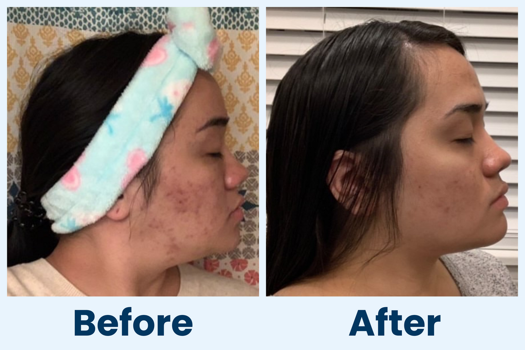 Clean Skin Club