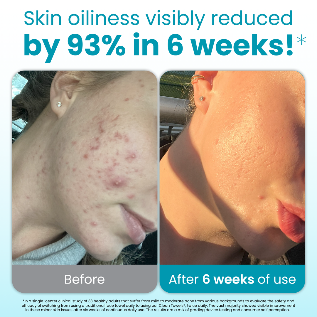 Clean Towels Blemish Control Subscription