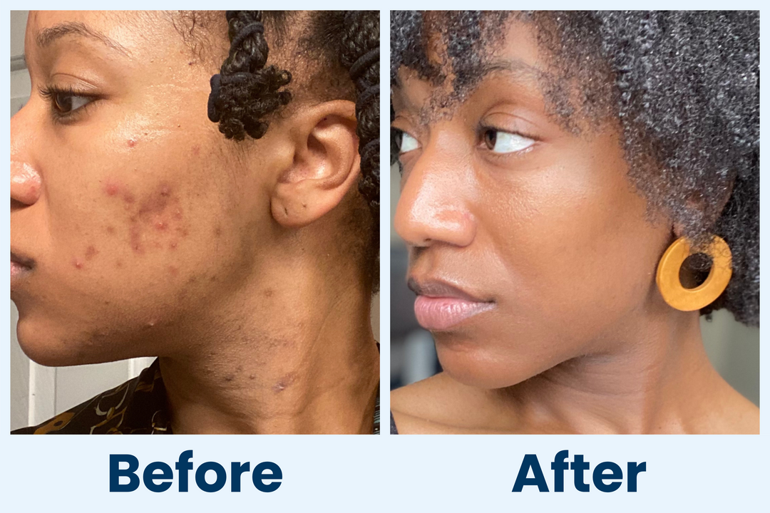 Clean Skin Club