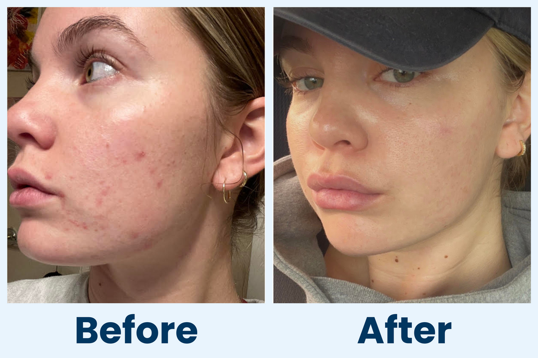 Clean Skin Club