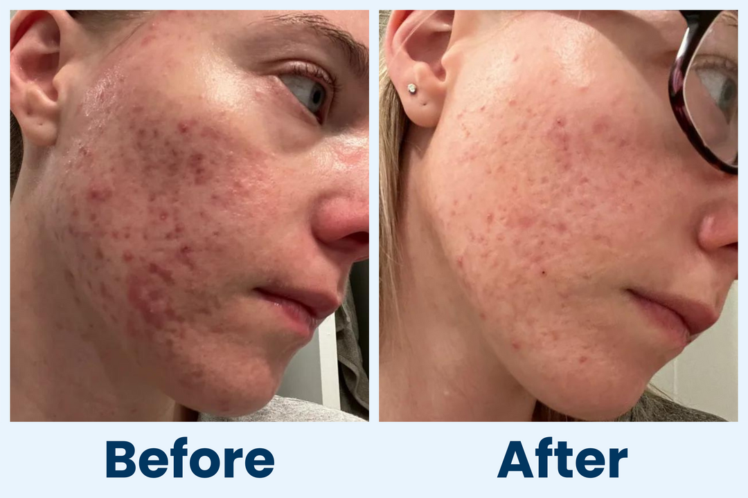 Clean Skin Club