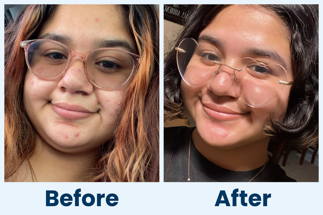 Clean Skin Club