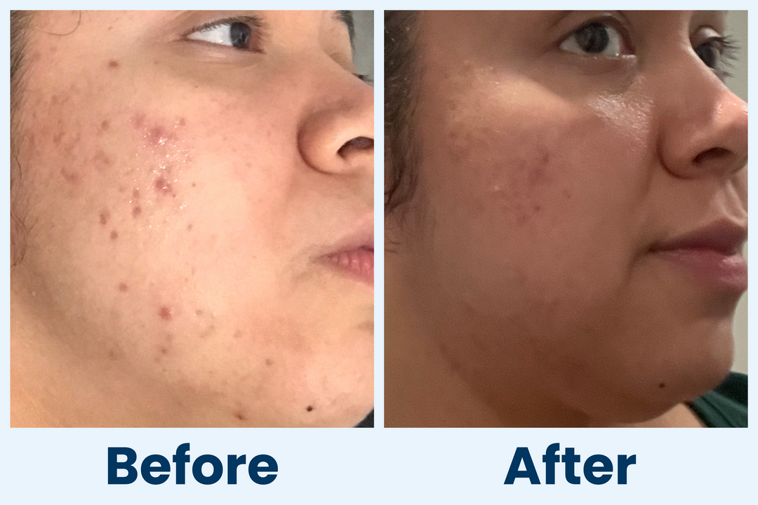 Clean Skin Club