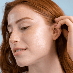 Can Vitamin D Cause Acne?