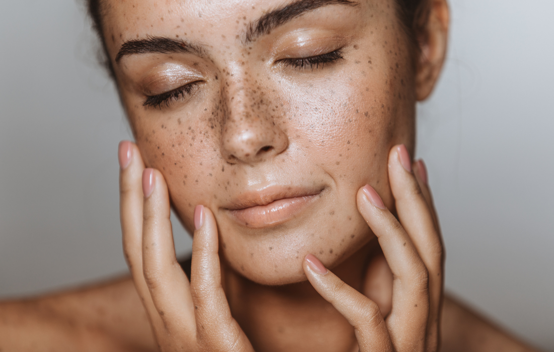 Tips to Limit Skin Picking