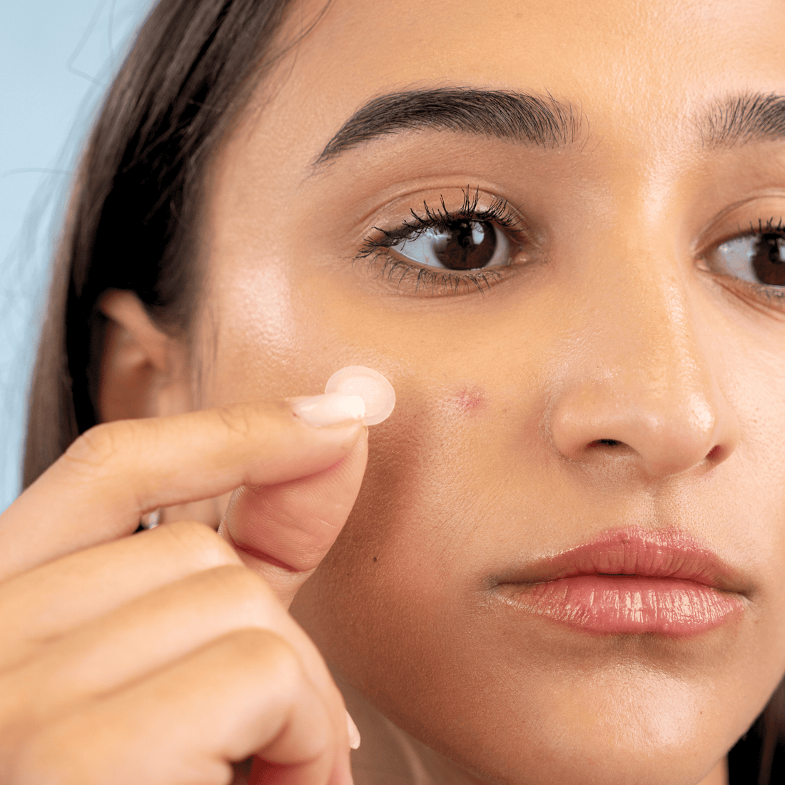 Best Acne Spot Treatments