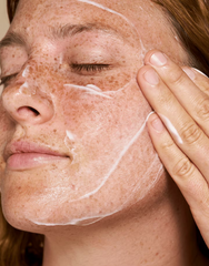 Which Skincare Ingredients Are Best for After Sun Care? (And Why)