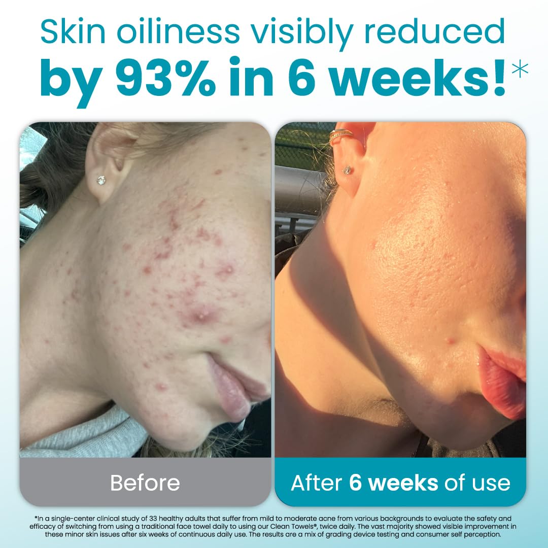 Clean Towels® Blemish Control Travel (10 count)