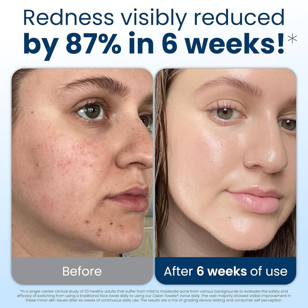 Clean Towels XL Exclusive Offer - Amazon EQB