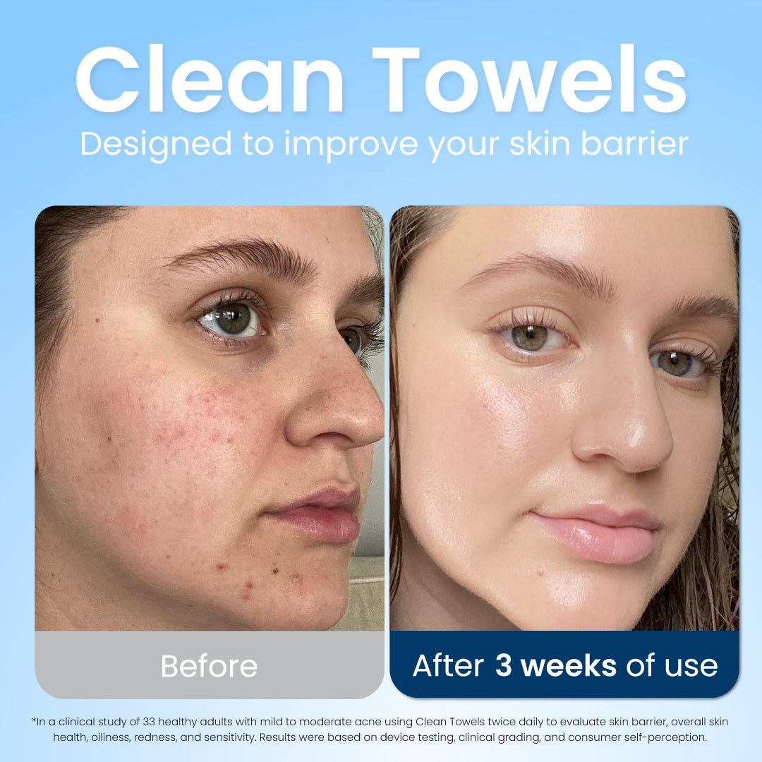 Clean Towel Original XL Before and After 3 Weeks - Designed to improve your skin barrier